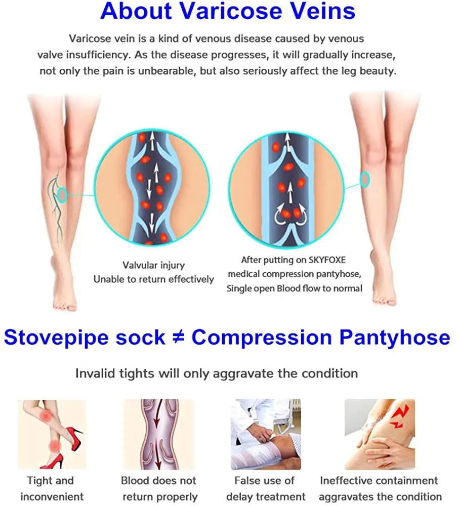 Collant médical de Compression pour varices, bas de Compression, 30-40 MmHg