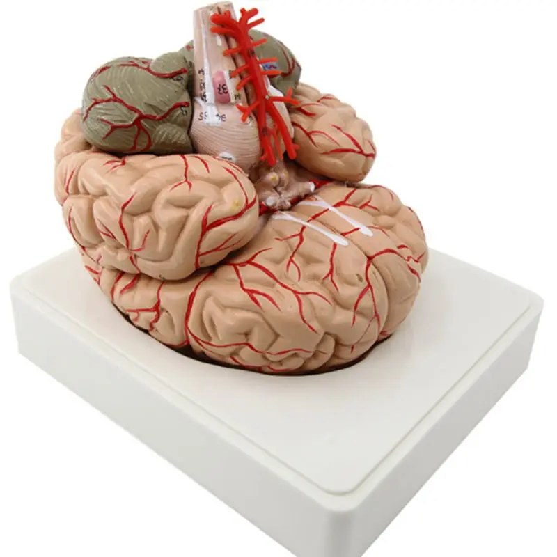 H-1003 Brain Anatomical Model, 9 Brain Arteries with 41 numbers markers