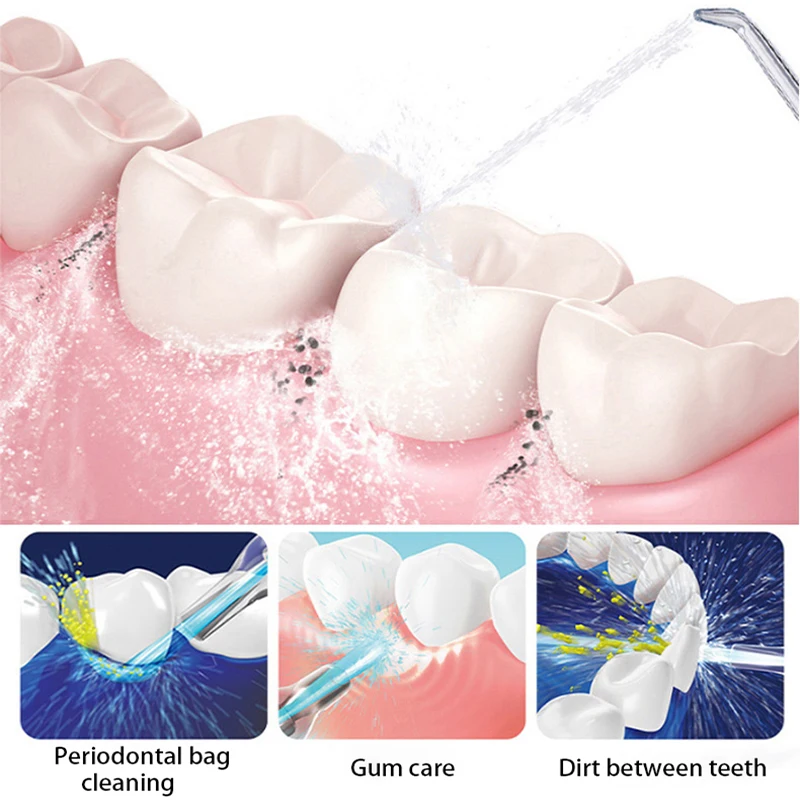 USB أداة ري الفم لطب الأسنان قشارة فوهة طائرة ل صنبور الأقواس للأسنان نظافة الفم غسالة 360 درجة دوران المياه الموضوع