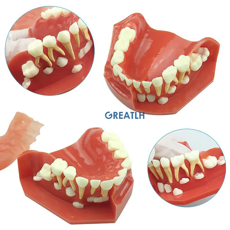 Dental Oral Model nauczania zębów podstawowych i stałych dla dzieci alternatywny Model zębów mlecznych wymiana zębów