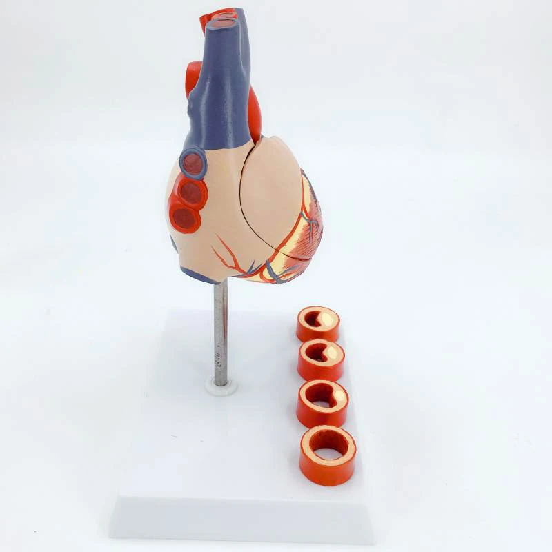 Heart vascular anatomical model Cardiac Teaching Medicine Heart with thrombus Model