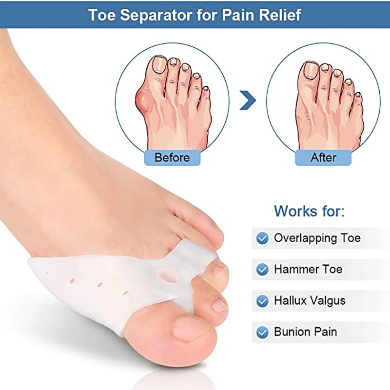 2 قطعة جل تو مفرشة أداة العناية بالقدم الورم مصحح أروح مستقيم العظام واقي إصبع القدم كبير باديكير مصحح #2