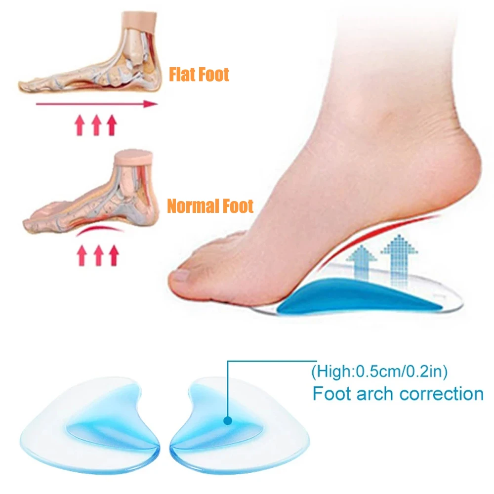 Orthopädische Einlegesohlen für Kinder, Schuheinlagen, Baby-Plattfußgewölbeunterstützung, Silikon-Gel-Einlegesohlen, orthesen für Plantarfasziitis – Detail 4