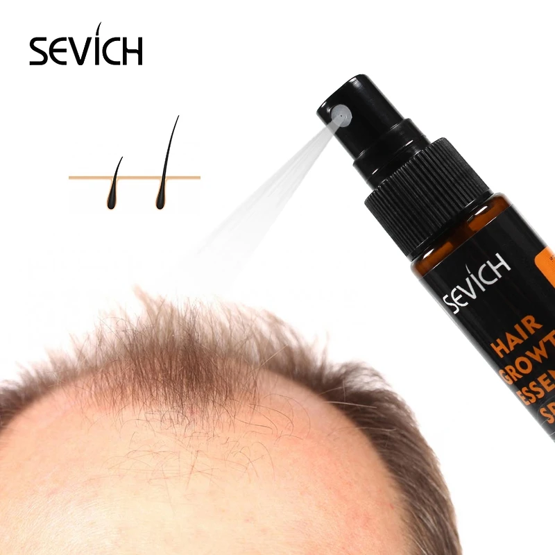 Sevich 30ml Hebal Oil Essence Fast Hair Growth Spray Hair Loss Treatment Help for hair Growth Hair Care