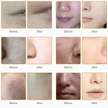 RF Face and Body Massager with LED #4