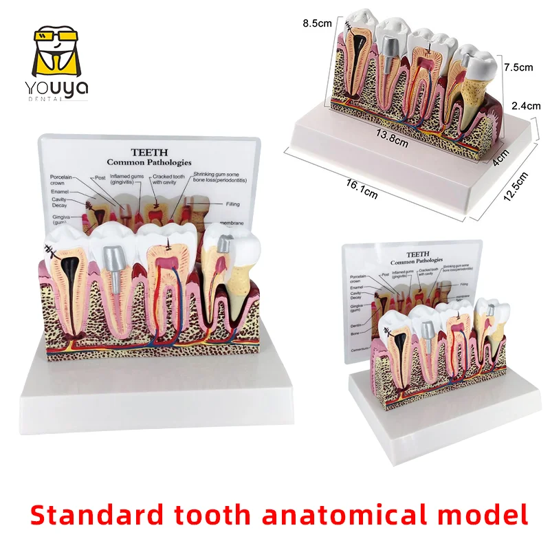 Standard Dental Oral Teeth Anatomical Teaching Model Comprehensive Tooth Structure Model Dentist Dental Student Demonstration