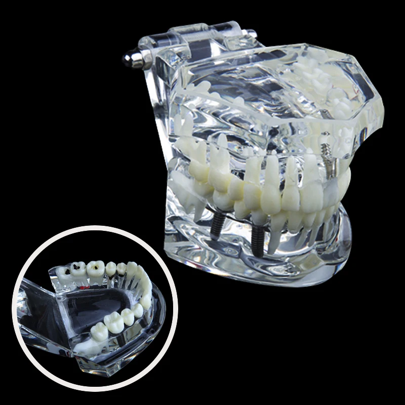 1pcs Dental lab equipment Dentist teeth anatomical model Classic Restoration Removable Model Teaching Resources