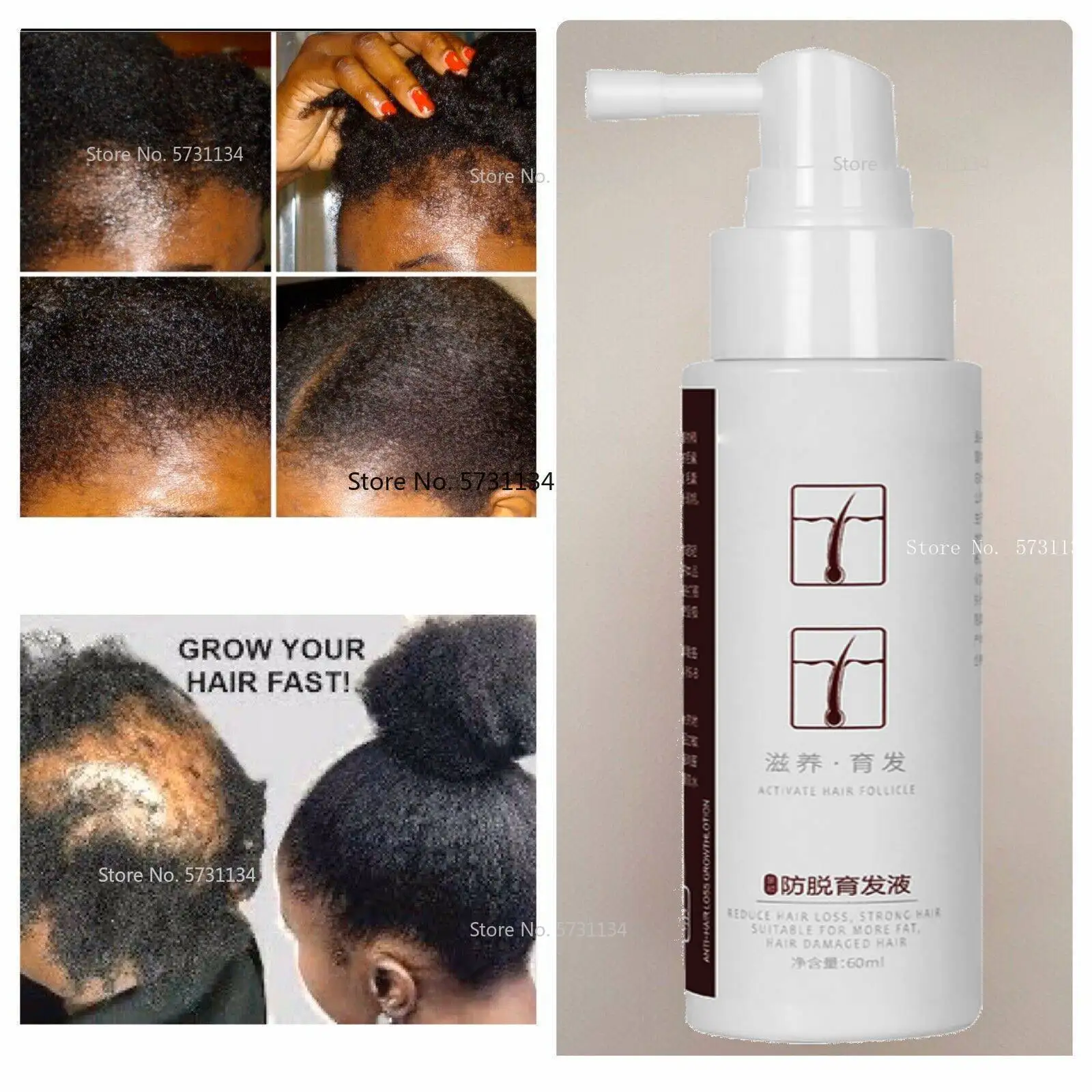 

HERBAL HAIR GROWTH Oil, Treats any hair condition, Treats alopecia