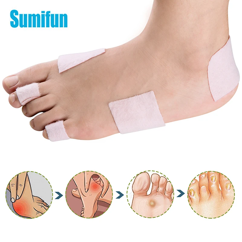 20pcs Foot Corn Sticker Waterproof Broken Toe Heel Protector Pad Adhesive Patch Plantar Warts Blister Fabric Anti-Friction D2538