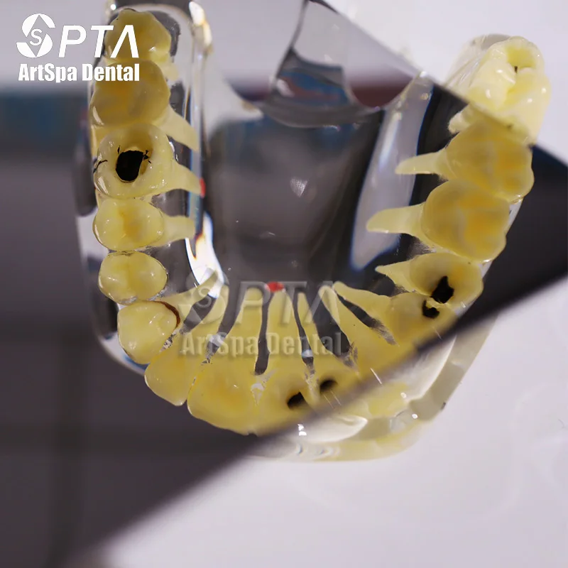 Enhance precision in dental procedures with the Dental Defogging Orthodontic Mirror LED set. Essential odontologia equipment