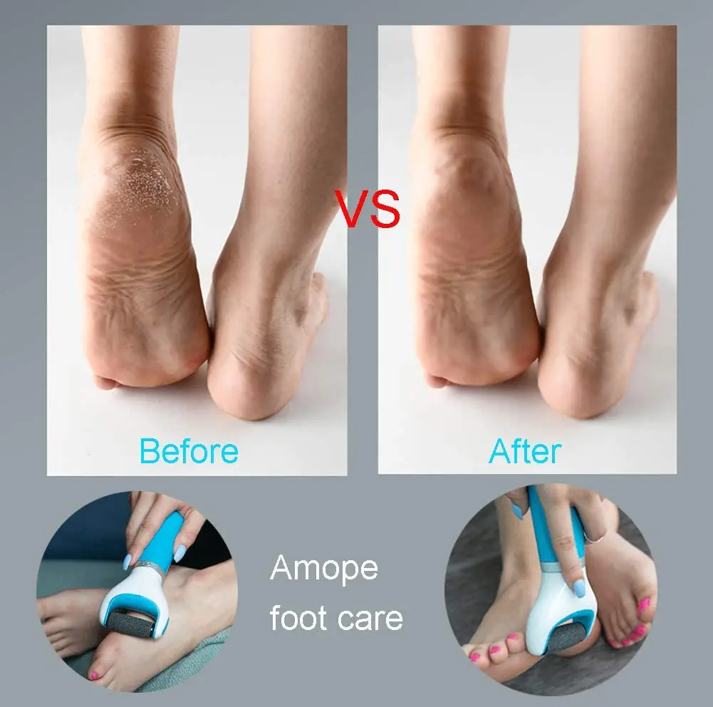 Electric Foot File Grinder Dead Skin Callus Remover for Foot Pedicure Tools Feet Care for Hard Cracked Foot Files Clean Tools bl