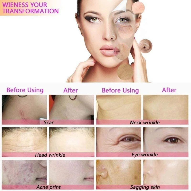 Diamond Microdermabrasion Beauty Machine Vacuum Suction Tool Water Spray Facial Moisten Face Exfoliate Skin Peeling Devices