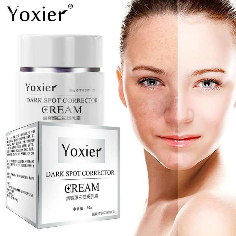 Dark Spot Corrector Skin Whitening Face Cream Lightening Pigmentation Age Spots Melasma Moisturizing Nourishing Skin Care 30g