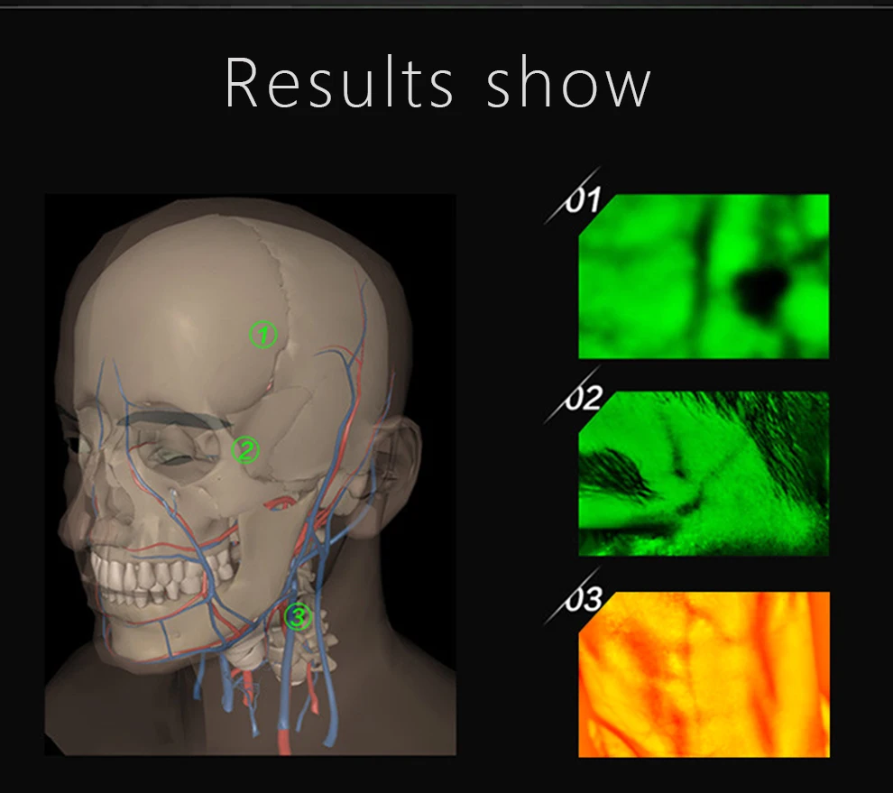Erwachsene Kinder geeignet Vene Viewer Display Lichter Bildgebung finden Vene Medical Vene Finder Vene Viewer – Detail 7