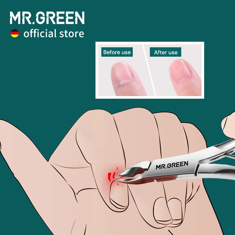 MR.GREEN-Coupe-ongles en acier inoxydable pour manucure, ciseaux, tondeuse, dissolvant de peau de fréquence, outil de pédicure