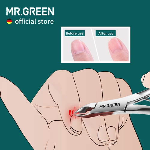 Imagen 2 del producto MR.GREEN-cortauñas de acero inoxidable para manicura, cortador de cutículas, removedor de piel muerta y pedicura