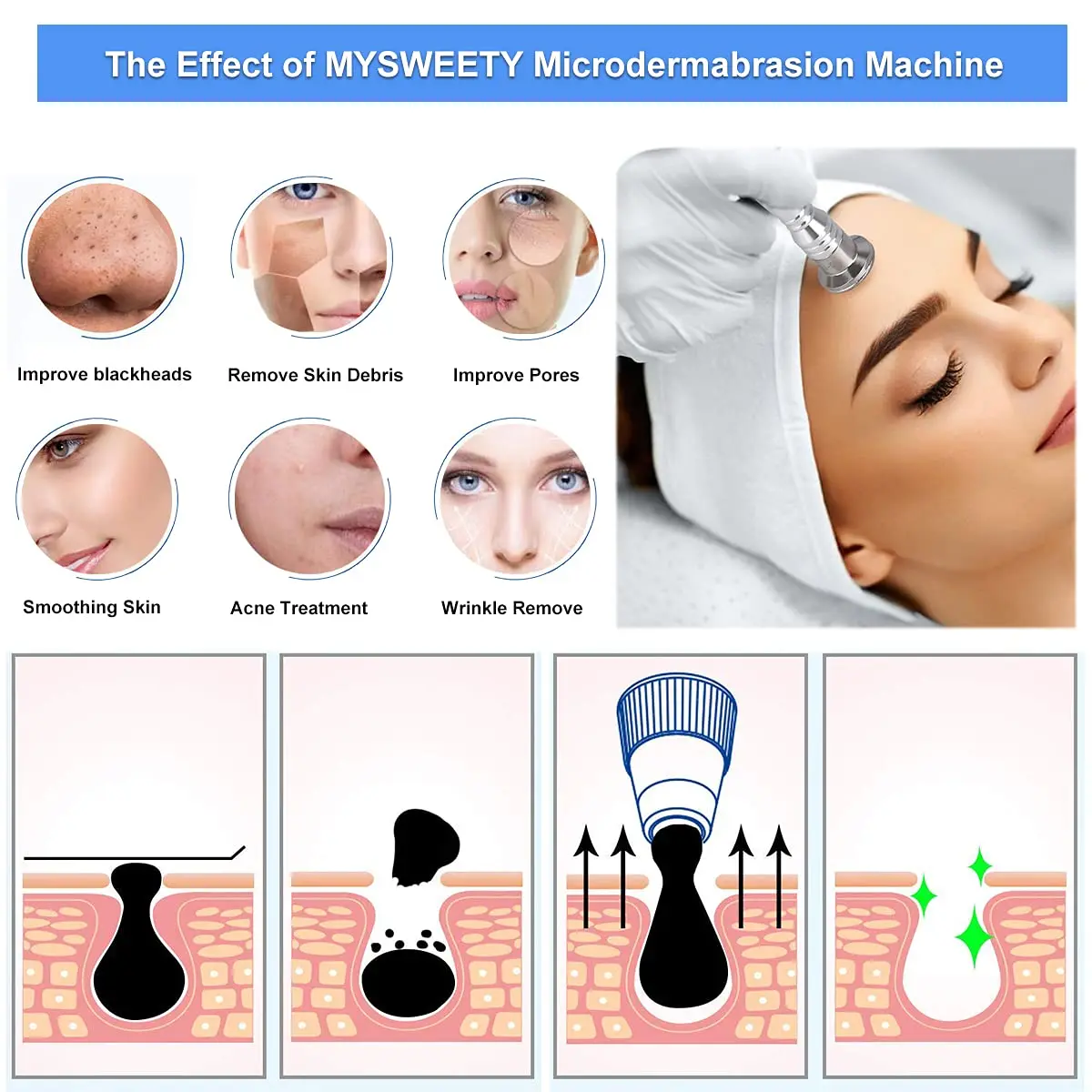 3 IN 1 Diamond Dermabrasion Microdermabrasion Machine Exfoliator Skin Rejuvenation Device, Wrinkle Removal, Safe Face Beauty