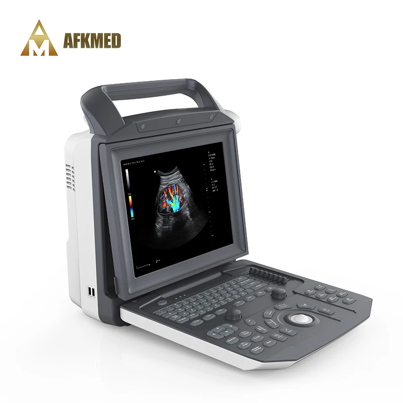 Op Verkoop Factory Aangepaste Draagbare Kleur Doppler Medische Echografie Instrumenten Ultrasound Machines