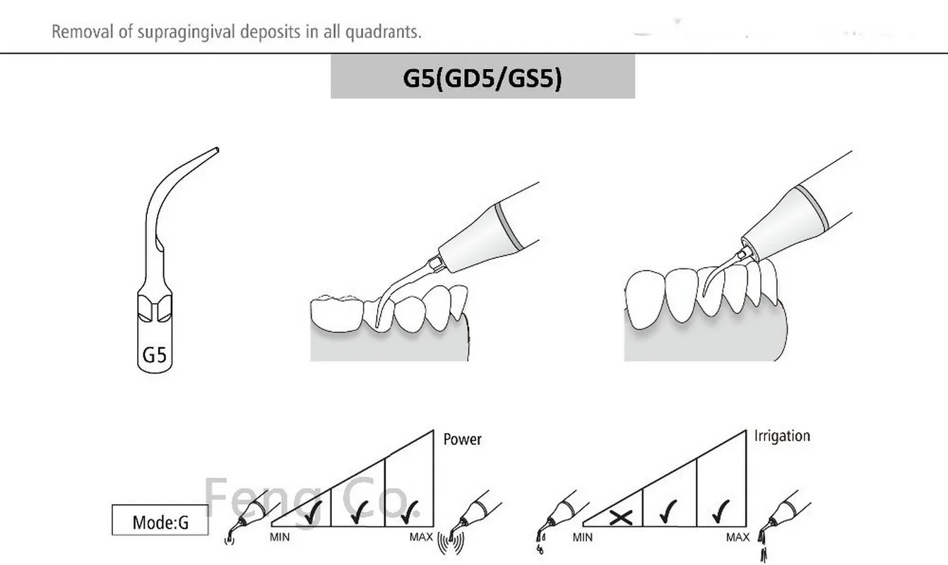 GD5 Dental Ultrasonic Scaler Tips Scaling  Endo Perio Fit SATELEC NSK DTE GNATUS HU-FREIDY Handpiece Dentist Teeth Whitening