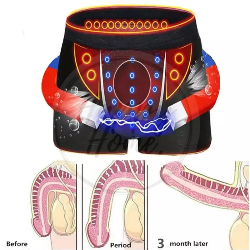 Boxer physiologique pour hommes, sous-vêtements magnétiques, fonction de soins de santé, maille respirante, short de thérapie magnétique, short énergétique