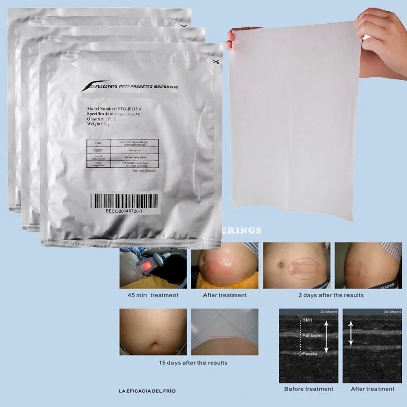 Factory Price  Membranes Antifreeze Membranes Lipolysis Cooling Therapy Body Slimming Use Anti Freezing Membranes