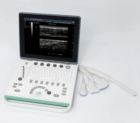 15 Inch Lcd Notebook Ultrasound Scanner Arm Based System USG