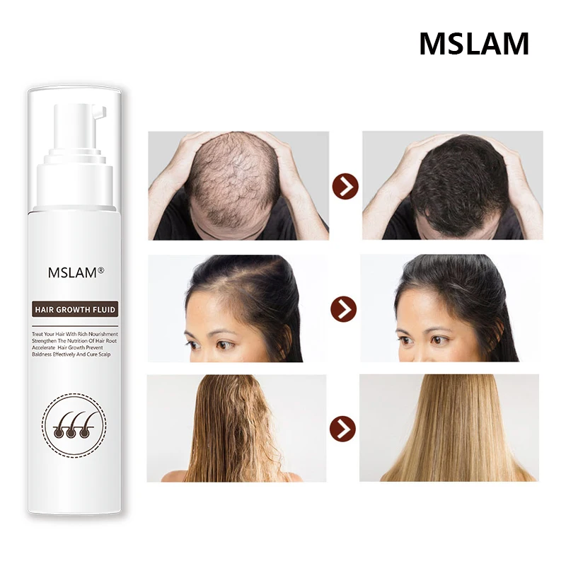 Msslam-productos para el crecimiento del cabello para hombres y mujeres, aceite de crecimiento rápido para el cuidado de la pérdida de cabello, tratamiento de belleza para el cabello y el cuero cabelludo