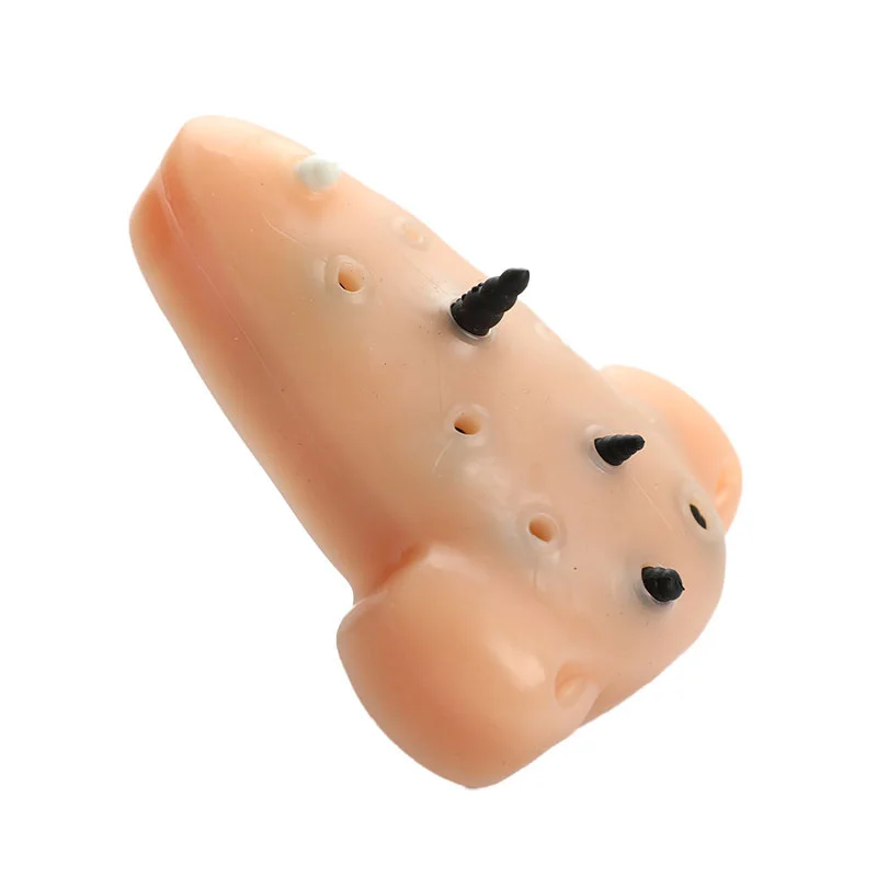 Blackhead Shape Pimple Toys Squeeze Acne Stress Relief Toys Remover Stop Toys