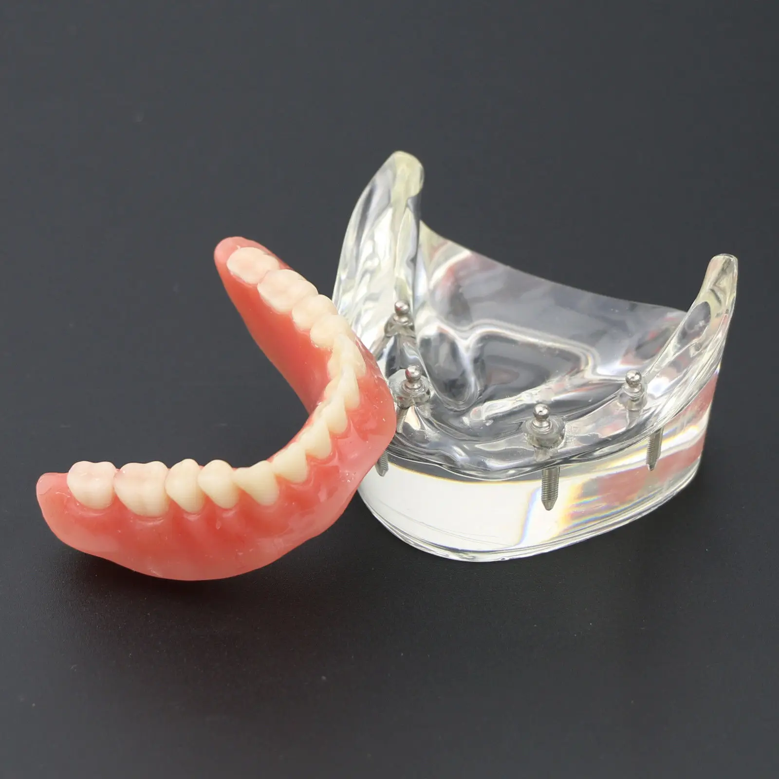 1Pc Dental Teeth Study Model Overdenture gorszy 4 Model demonstracyjny implantu 6002 02