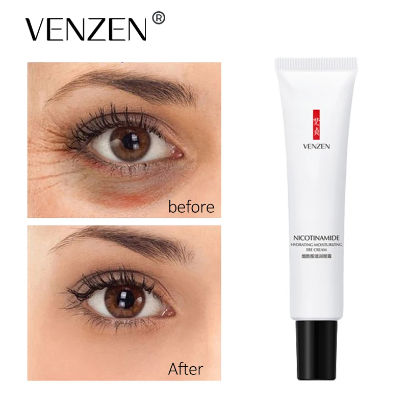 VEZE Niacinamide Moisturizing Eye Cream Anti-Age Remove Dark Circles Against-Puffiness And Eye Bags Nourishing Eye Care