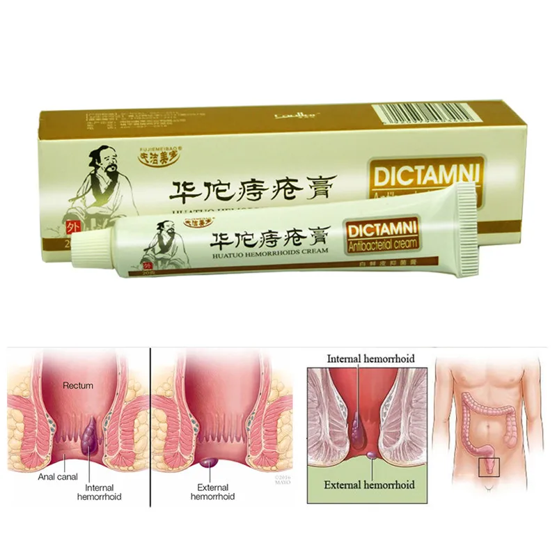 Ifory Dropship Hemorrhoids Ointment Sterilize Cream For Internal Hemorrhoids Piles Pain Relief External Anal Fissure Therapy