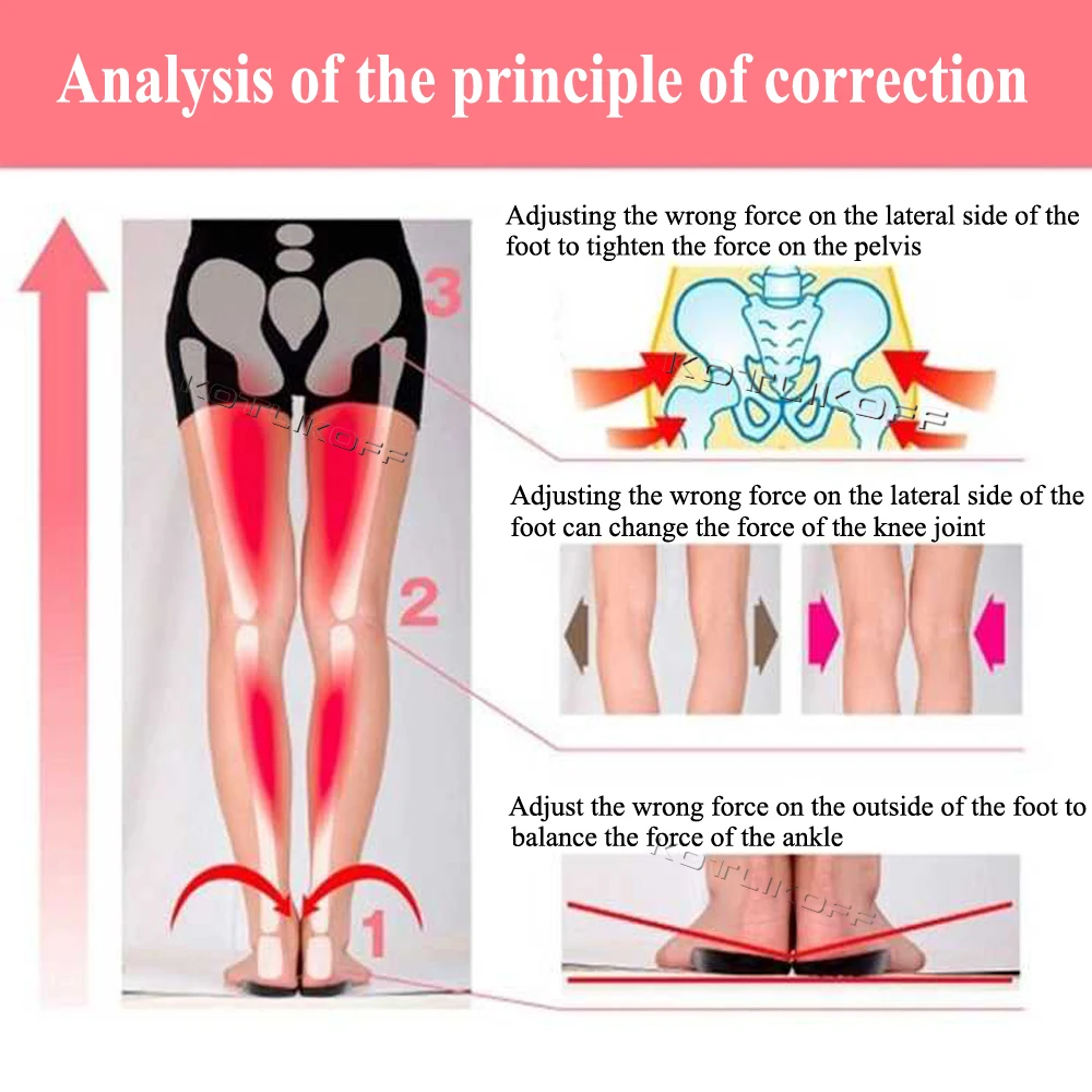 Orthopedic O/X-Leg Legs Relieve Insoles Silicone Soft Self-adhesive Corrector Valgus Varus Relieve Pain Massage Foot Care Insert image 2