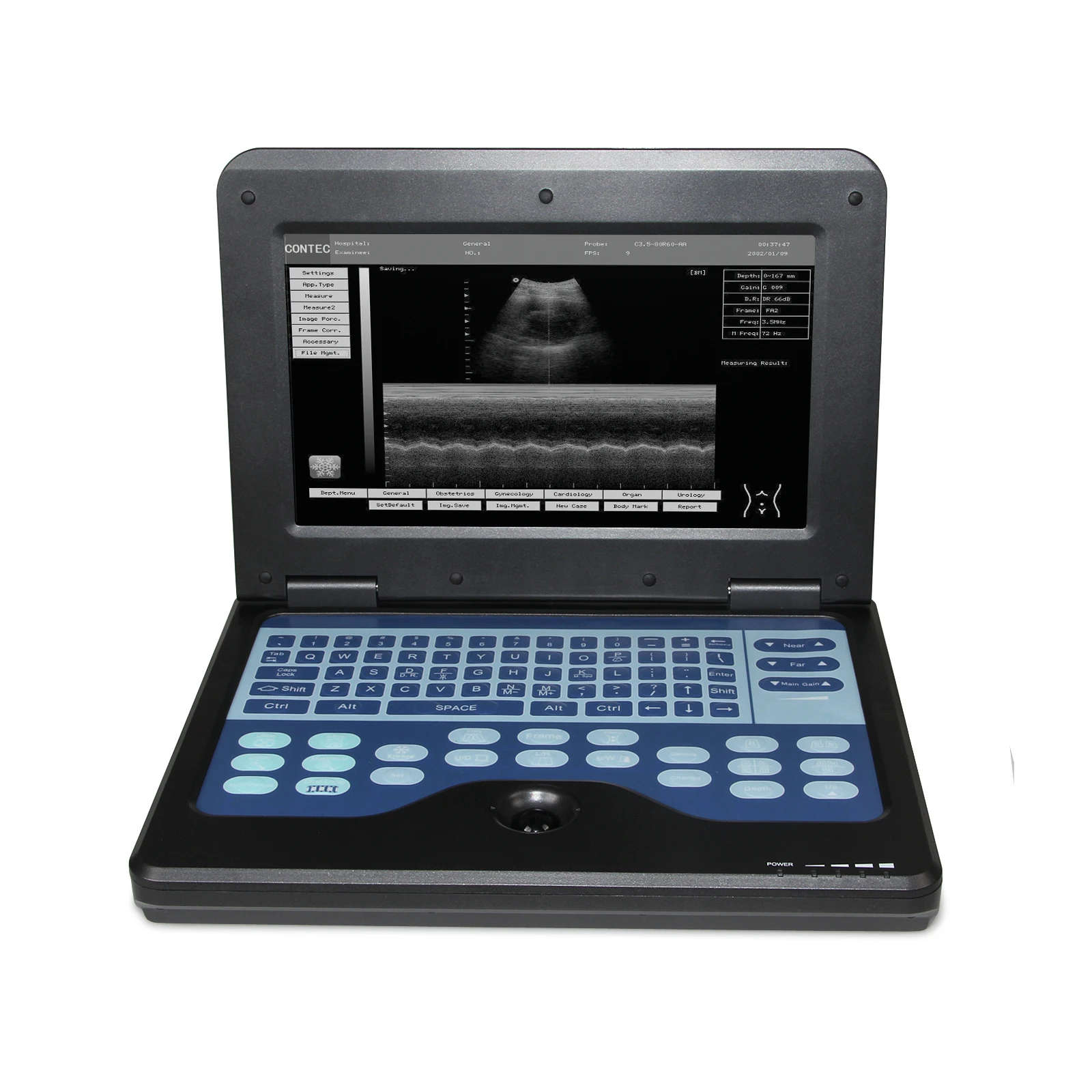 CONTEC CMS600P2 with 6.5Mhz Transvaginal probe Portable B-untrasound  Laptop Machine Digital Ultrasound Scanner