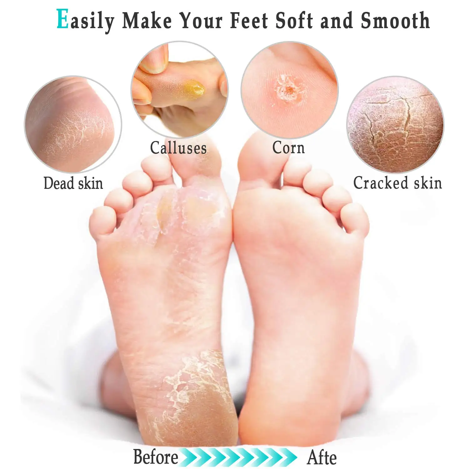 Electric Foot File Grinder Dead Dry Skin Callus Remover Rechargeable Feet Pedicure Tool Foot Care Tools for Hard Cracked Clean