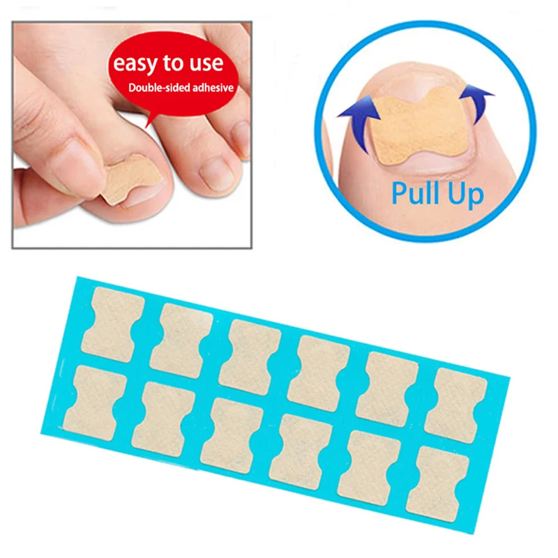 36pcs/pack Ingrown Toenail Correction Tool Toe Nail Treatment Elastic Patch Sticker Clip