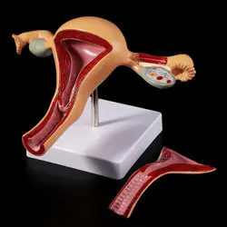 Medical props model Human Pathological Uterus Ovary Model Anatomical Anatomy Disease Pathology Medical Lesion For Teaching