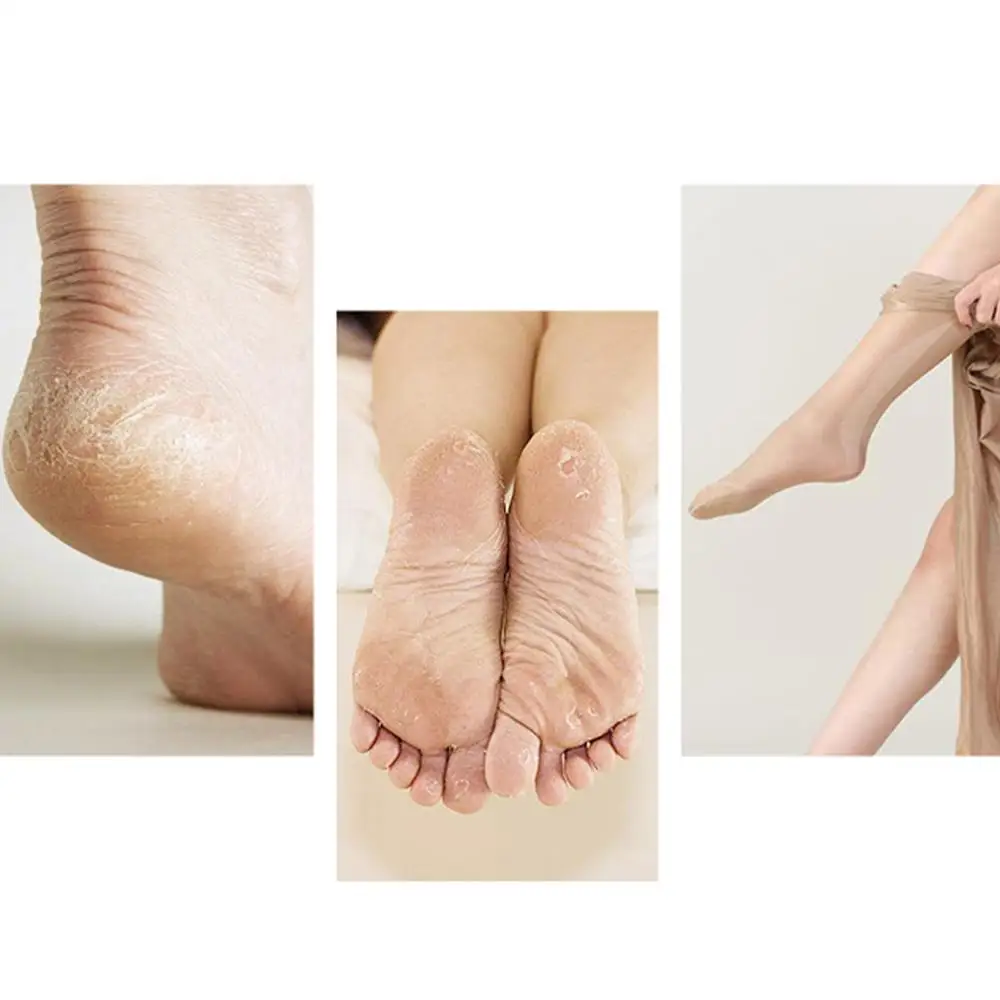 2 pçs eletrônico pedicure recargas rolos pés arquivo máquina de reparo ferramentas cuidados com os pés rolos remoção da pele dura pés dispositivo