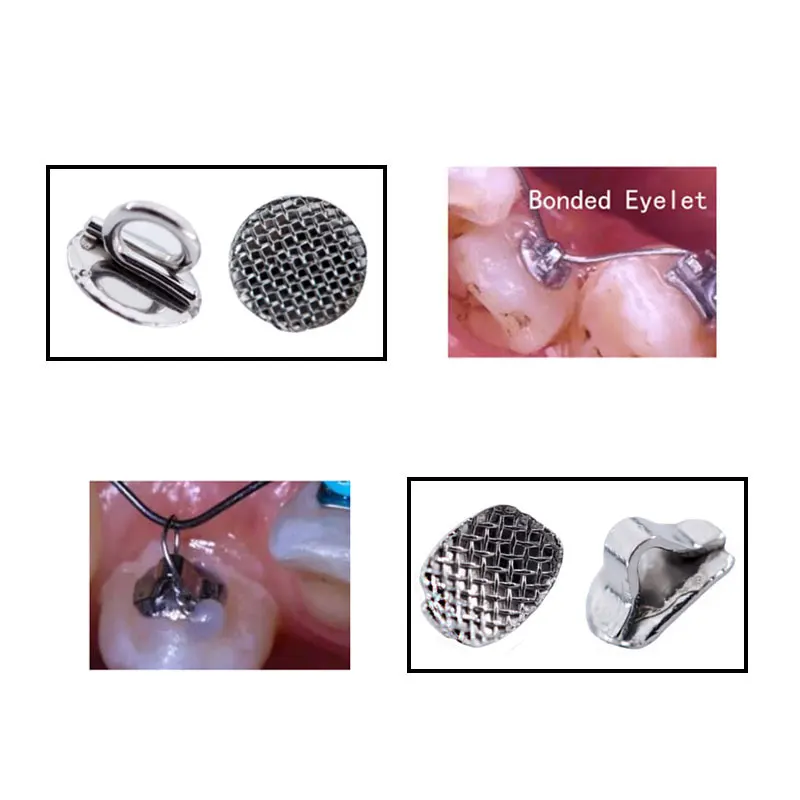 Crochets de Traction en métal Composite, 10 pièces, pour dentisterie, matériaux orthodontiques