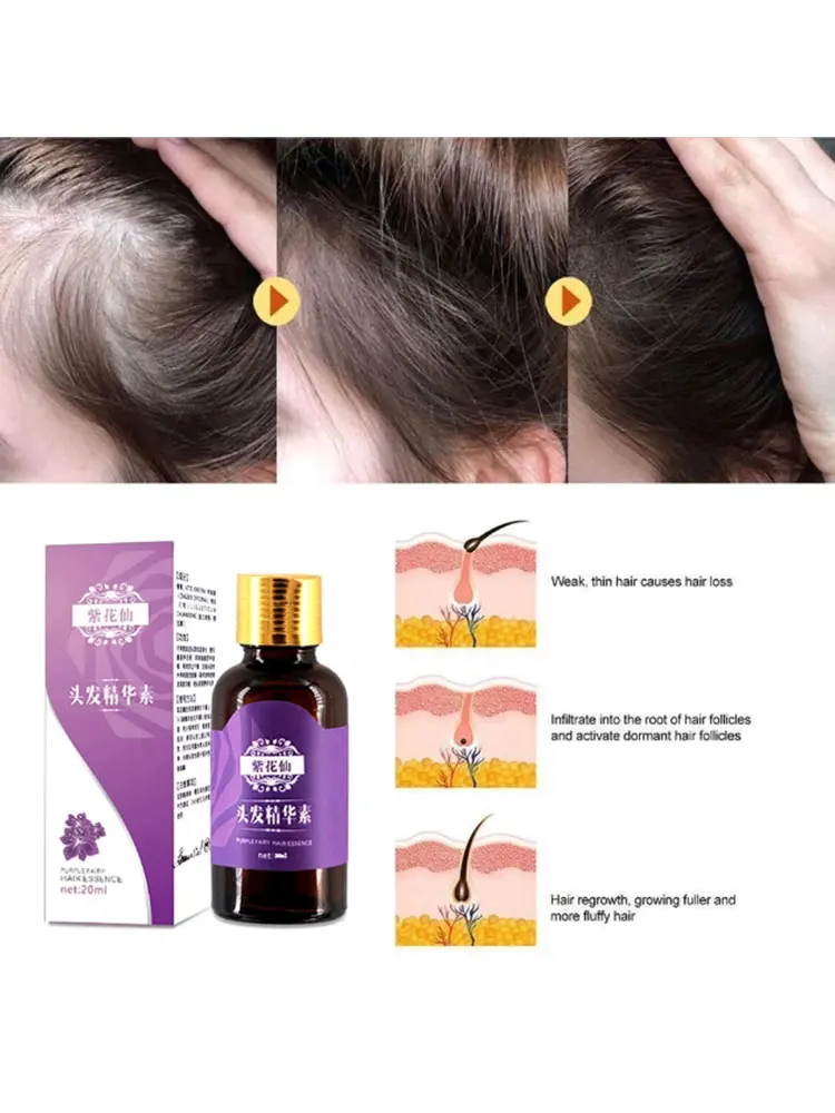 Natural hair loss products, no side effects, faster hair growth