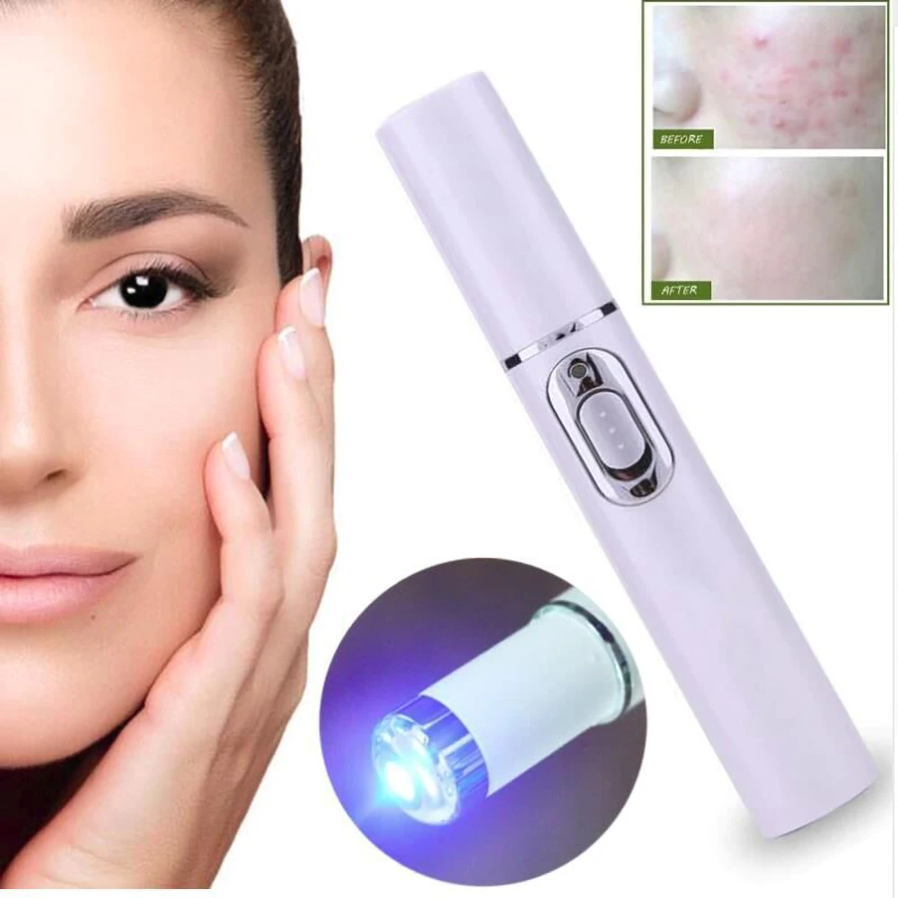 Penna Laser per Acne macchina portatile per la rimozione delle rughe cicatrice morbida rimozione dei cerchi scuri durevole terapia della luce blu