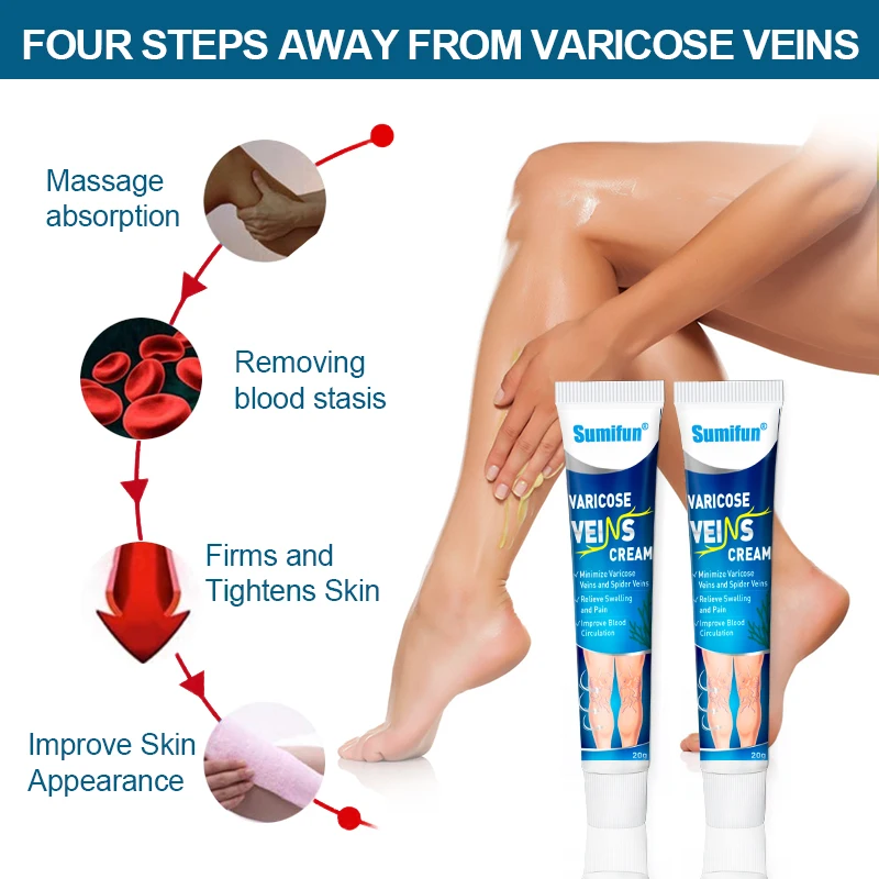 Sumifun Varicose Vein Cream Varicosity Angiitis Spider Removal Legs Dilated Treatments Patch Phlebitis Pain Relief Health Care