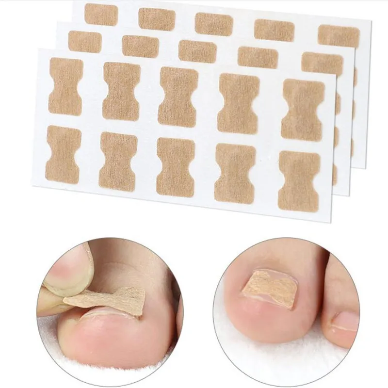 Ingrown Toenail Corrector Sticker Paronychia Treatment Fixer Recover Corrector Pedicure Foot Toe Nail Care Tool Glue Free