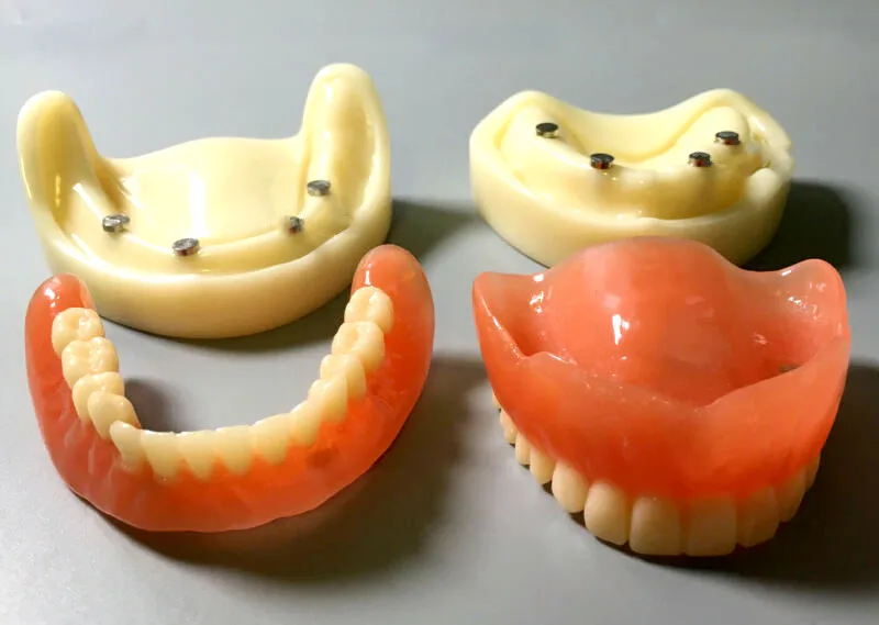 Dental pełna proteza Model Overdenture magnetyczne mocowanie górne badanie żuchwy