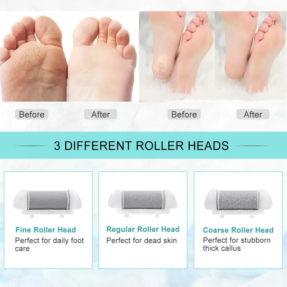 3/6PCS Foot Care Tool Heads Pedi Dead Hard Skin Callus Remover Refills Grinder Replacement Rollers File Feet Care Tool