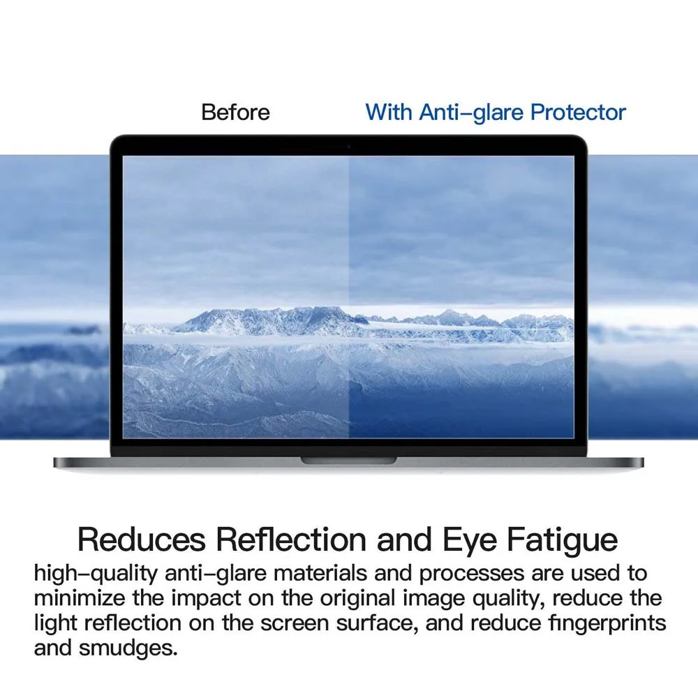 For Apple Macbook Pro Macbook retina12 inch Model A1534 Crystal Clear Lcd Guard Film Laptop Screen Protector Cover
