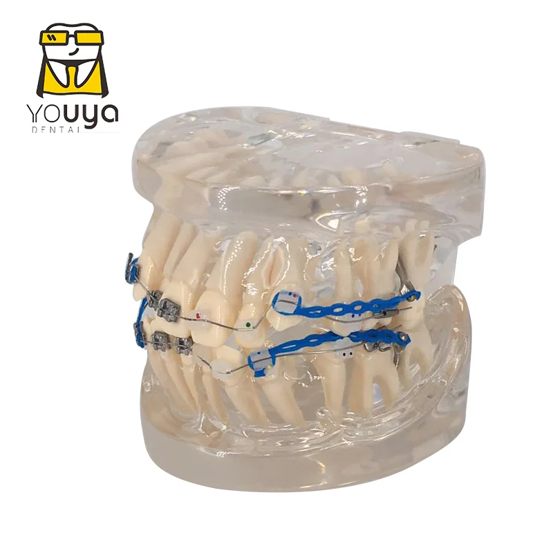 Dental Model With Braces Dentistry Materials Orthodontic Models Gum Tooth Teeth Model For Studying Teaching Patient Education