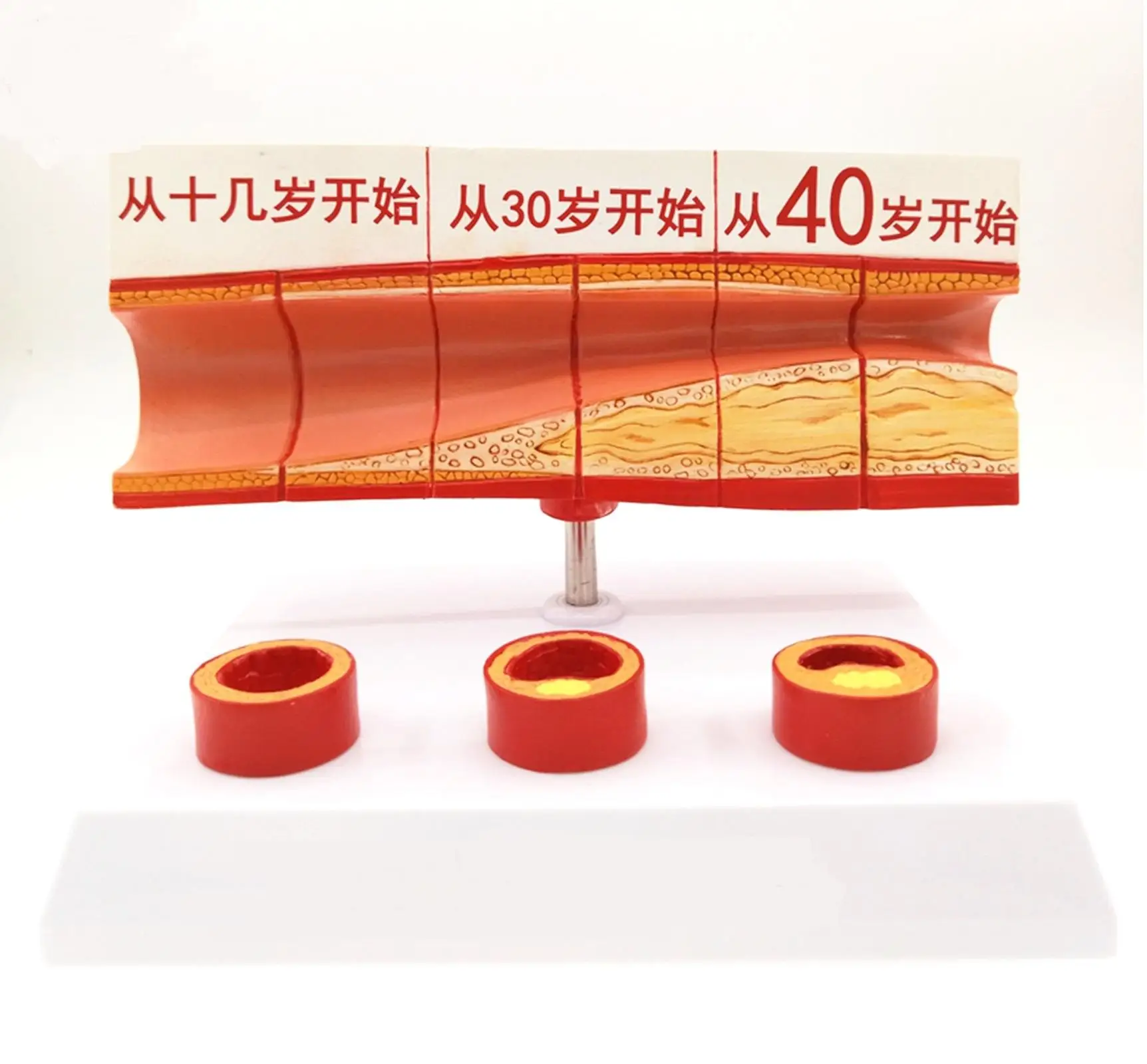 PVC Human Age Vascular Obstruction Medical Model Clear Texture