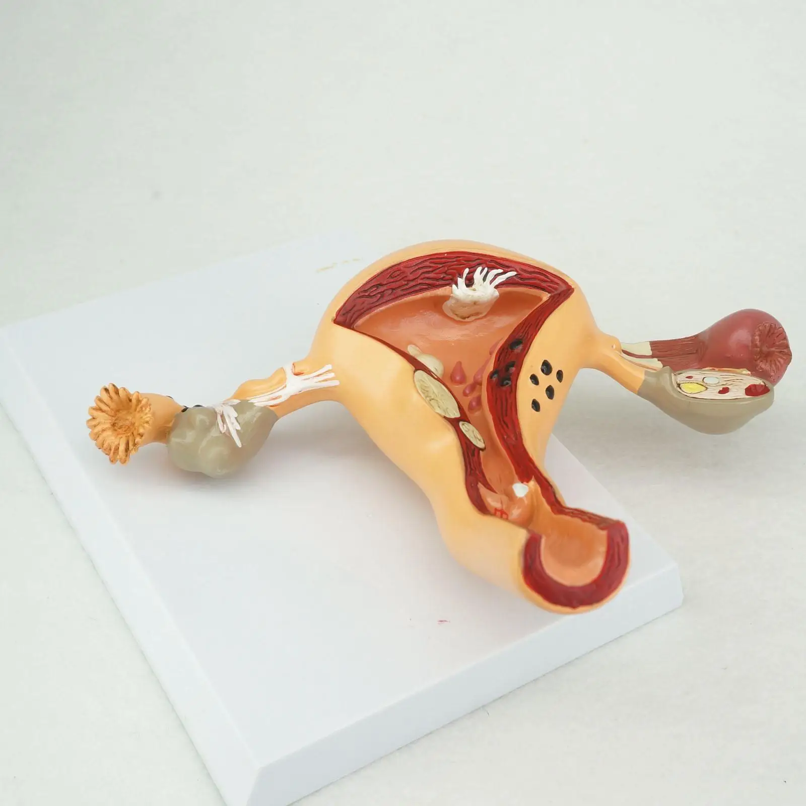 

Pathological Uterus and Ovary Anatomical Model Human Female Medical Anatomy Learning Kit Teaching Resources