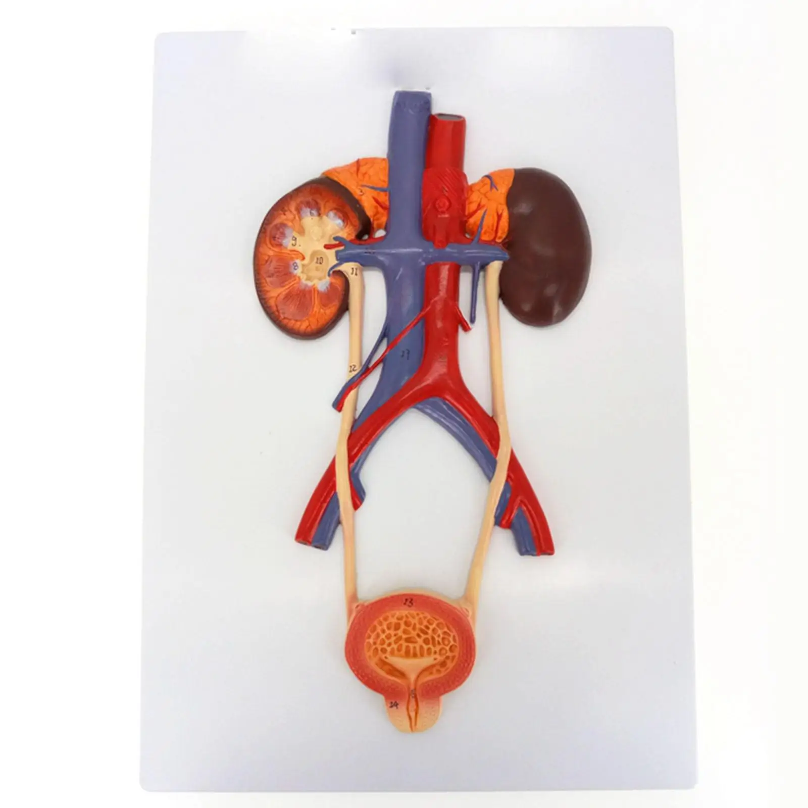 

Anatomy Teaching Model Medical Bladder Liver Kidney Wall Plaque Urinary System Teaching Resources