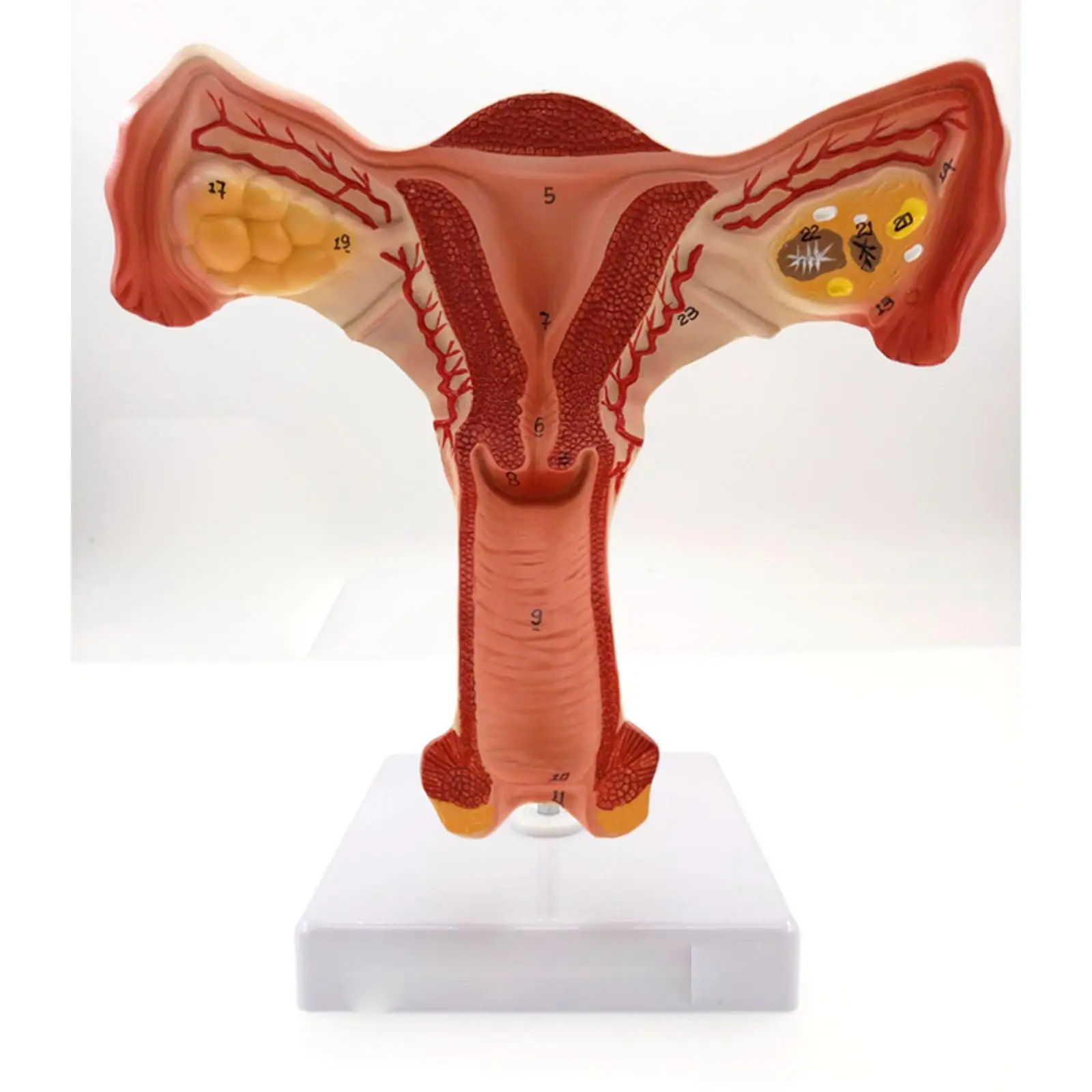 

Uterus and Ovary Anatomical Model Human Female Medical Anatomy Internal Genital Organ Teaching Resources Medical teaching tools